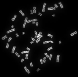 Chromosomes d'un être humain © Abogomazova / Wikipedia commons