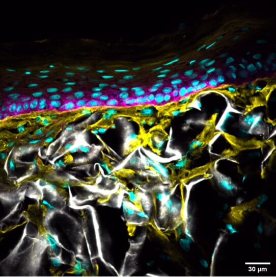 Image de peau en immunofluorescence. L'épiderme et ses différentes couches apparaissent en rose. Le derme, avec ses fibres de collagène, apparaît en gris et jaune. Les noyaux des cellules (kératinocytes dans l'épiderme / fibroplastes dans le derme) apparaissent en bleu. © Seyta LEY-NGARDIGAL